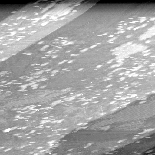 02020600BL