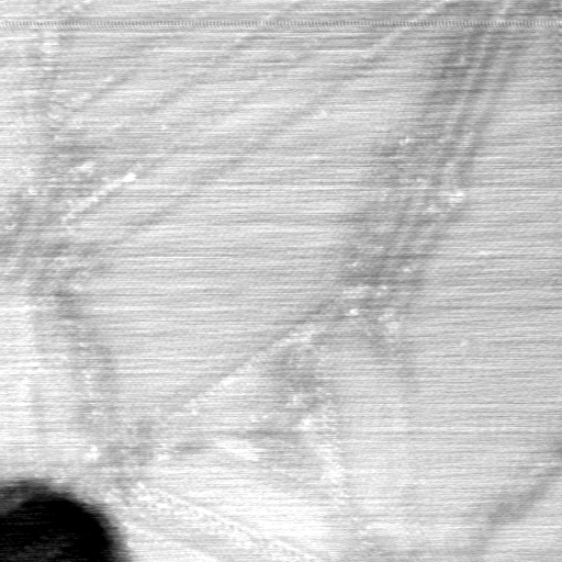 040306AT