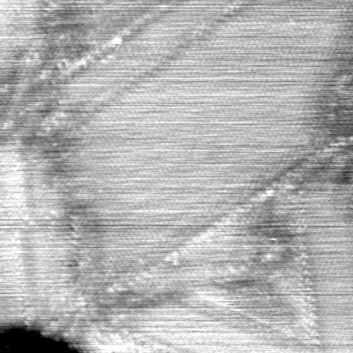 040306BG