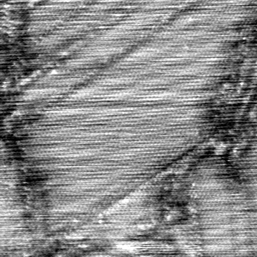 040306BS