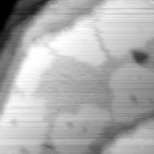 052907BL