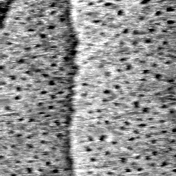 CI011504